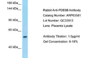 Western Blotting (WB) image for anti-phosphodiesterase 6B, CGMP-Specific, Rod, beta (PDE6B) (N-Term) antibody (ABIN2789554)