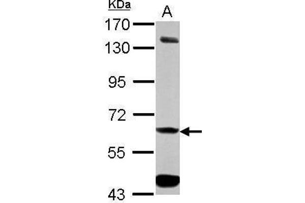 ALDH7A1 抗体