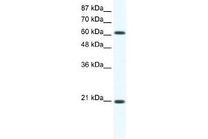 WB Suggested Anti-Anxa6 Antibody Titration:  1. (ANXA6 抗体  (C-Term))