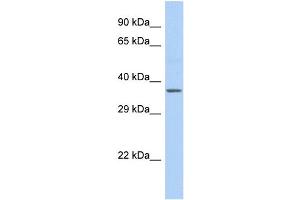 Host:  Rabbit  Target Name:  cytb  Sample Type:  Fetal Liver lysates  Antibody Dilution:  1. (Cytochrome b 抗体  (C-Term))