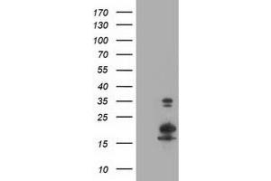 Western Blotting (WB) image for anti-LSM1 Homolog, U6 Small Nuclear RNA Associated (LSM1) antibody (ABIN1499210) (LSM1 抗体)