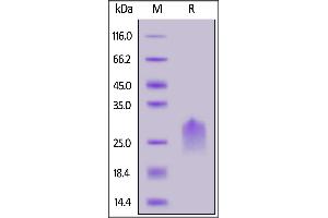 SDS-PAGE (SDS) image for Poliovirus Receptor-Related Immunoglobulin Domain Containing (PVRIG) (AA 41-171) (Active) protein (His tag) (ABIN7013667)