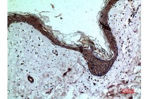 Immunohistochemistry (IHC) analysis of paraffin-embedded Human Skin, antibody was diluted at 1:100. (IL-8 抗体  (C-Term))