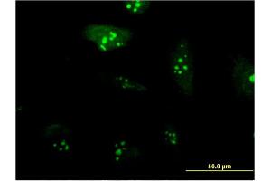 Immunofluorescence of monoclonal antibody to RPL23A on HeLa cell. (RPL23A 抗体  (AA 59-156))