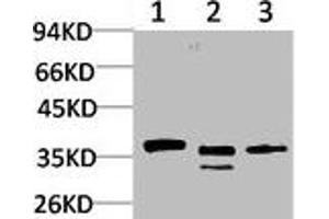 Western Blotting (WB) image for anti-Calcium Channel, Voltage-Dependent, gamma Subunit 2 (CACNG2) antibody (ABIN7189155)