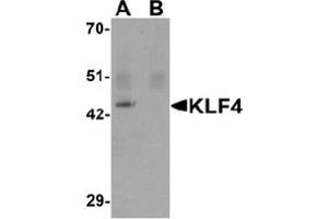 Image no. 1 for anti-Kruppel-Like Factor 4 (Gut) (KLF4) (C-Term) antibody (ABIN1449394) (KLF4 抗体  (C-Term))