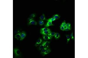 Immunofluorescence staining of HepG2 cells with ABIN7158268 at 1:166, counter-stained with DAPI. (LILRB2 抗体  (AA 406-563))