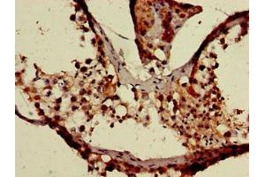 Immunohistochemistry of paraffin-embedded human testis tissue using ABIN7175921 at dilution of 1:100 (XAF1 抗体  (AA 172-259))