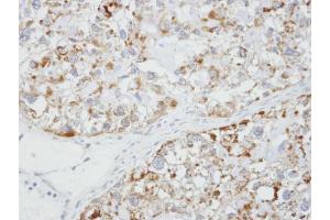 IHC-P Image Immunohistochemical analysis of paraffin-embedded OVCA xenograft, using Glycine Receptor alpha1, antibody at 1:100 dilution. (GLRA1 抗体)