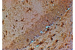 Immunohistochemistry (IHC) image for anti-Transient Receptor Potential Cation Channel, Subfamily M, Member 7 (TRPM7) (C-Term) antibody (ABIN184611)