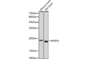 Western blot analysis of extracts of various cell lines, using RA antibody (ABIN3021646, ABIN3021647, ABIN3021648 and ABIN1513457) at 1:500 dilution. (RAB5 抗体  (AA 1-215))