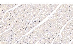 Detection of ITGa5 in Bovine Cardiac Muscle Tissue using Polyclonal Antibody to Integrin Alpha 5 (ITGa5) (ITGA5 抗体  (AA 649-900))