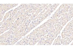 Detection of ITGa5 in Bovine Cardiac Muscle Tissue using Polyclonal Antibody to Integrin Alpha 5 (ITGa5) (ITGA5 抗体  (AA 649-900))