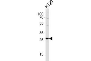 Western Blotting (WB) image for anti-Nicotinamide N-Methyltransferase (NNMT) antibody (ABIN2997531) (NNMT 抗体)