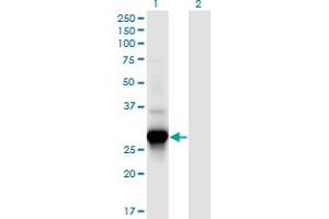 Western Blot analysis of C4orf43 expression in transfected 293T cell line by C4orf43 monoclonal antibody (M08), clone 4A6. (C4orf43 抗体  (AA 1-203))