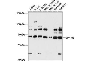Western blot analysis of extracts of various cell lines, using GPNMB antibody (ABIN7269117) at 1:3000 dilution. (Osteoactivin 抗体  (AA 22-260))