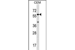 CYP21A2 Antibody (Center) (ABIN1537905 and ABIN2848684) western blot analysis in CEM cell line lysates (35 μg/lane). (CYP21A2 抗体  (AA 160-188))