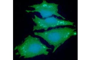 ICC/IF analysis of NDRG1 in HeLa cells line, stained with DAPI (Blue) for nucleus staining and monoclonal anti-human NDRG1 antibody (1:100) with goat anti-mouse IgG-Alexa fluor 488 conjugate (Green). (NDRG1 抗体  (AA 1-394))