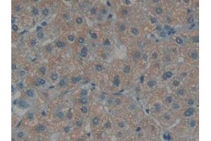 Detection of EDN1 in Human Liver Tissue using Polyclonal Antibody to Endothelin 1 (EDN1) (Endothelin 1 抗体  (AA 53-90))