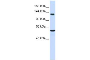 WB Suggested Anti-IGSF1 Antibody Titration:  0. (IGSF1 抗体  (Middle Region))