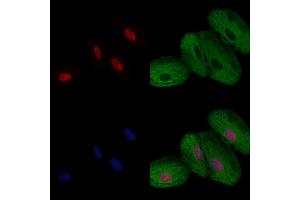 ABIN6257258 and ABIN6274281 staining  cells by IF/ICC. (HNRNPF 抗体  (N-Term))