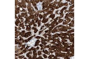 Immunohistochemical staining of human liver with SLC25A43 polyclonal antibody  shows strong cytoplasmic positivity in hepatocytes.