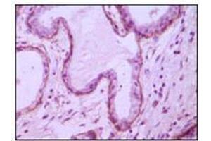 Immunohistochemical analysis of paraffin-embedded human breast ductal myoepithelium,showing cytoplasmic and membrane location with DAB staining using CD10 mouse mAb. (MME 抗体)