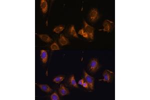 Immunofluorescence (IF) image for anti-Ribosomal Protein L32 (RPL32) (AA 1-135) antibody (ABIN6147138)