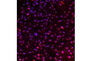 Immunofluorescence of paraffin embedded mouse brain using USP34 (ABIN7076115) at dilution of 1:700 (400x lens) (USP34 抗体)