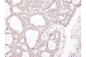 Immunohistochemistry (IHC) image for anti-Chromodomain Helicase DNA Binding Protein 3 (CHD3) (AA 1950-2000) antibody (ABIN7448475) (CHD3 抗体  (AA 1950-2000))