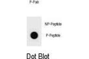 Dot blot analysis of mouse BAD Antibody (Phospho T94) Phospho-specific Pab s on nitrocellulose membrane.