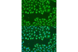 Immunofluorescence analysis of U2OS cells using SSB antibody (ABIN1874948) at dilution of 1:100. (SSB 抗体)