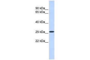 WB Suggested Anti-KLF14 Antibody Titration:  0. (KLF14 抗体  (N-Term))