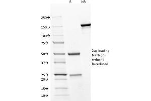 SDS-PAGE Analysis Purified CD31 Mouse Monoclonal Antibody (JC/70A).