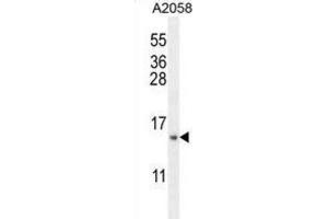 Western Blotting (WB) image for anti-Mitochondrial Ribosomal Protein S24 (MRPS24) antibody (ABIN2995673) (MRPS24 抗体)