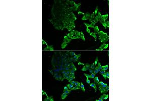 Immunofluorescence analysis of MCF-7 cells using SCYL1 antibody (ABIN5974072). (SCYL1 抗体)