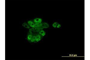 Immunofluorescence of monoclonal antibody to RARA on A-431 cell.
