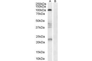 Western Blotting (WB) image for anti-Reticulon 4 (RTN4) (AA 166-179) antibody (ABIN292274) (Reticulon 4 抗体  (AA 166-179))