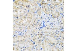 Immunohistochemistry (Paraffin-embedded Sections) (IHC (p)) image for anti-Toll-Interleukin 1 Receptor (TIR) Domain Containing Adaptor Protein (TIRAP) (AA 1-221) antibody (ABIN6149192)