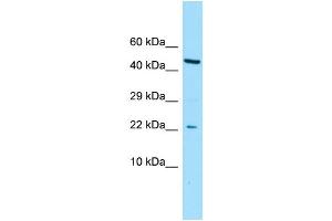 WB Suggested Anti-CGGBP1 Antibody Titration: 1. (CGGBP1 抗体  (N-Term))
