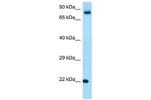 WB Suggested Anti-FGF18 Antibody Titration: 1. (FGF18 抗体  (C-Term))