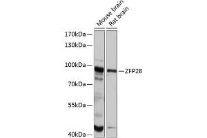 Western blot analysis of extracts of various cell lines, using ZFP28 antibody (ABIN6133031, ABIN6150430, ABIN6150431 and ABIN6215838) at 1:1000 dilution.