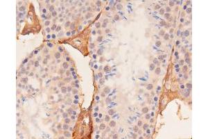 ABIN6267537 at 1/100 staining mouse kidney tissue sections by IHC-P. (YAP1 抗体  (pSer127))
