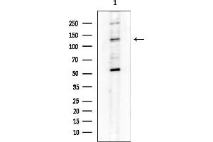 anti-Integrin alpha 1 (ITGA1) (Internal Region) antibody
