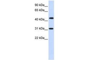 Image no. 1 for anti-Zinc Finger Protein 684 (ZNF684) (AA 72-121) antibody (ABIN6740403) (ZNF684 抗体  (AA 72-121))