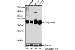 Western blot analysis of extracts of various cell lines, using Caspase-6 antibody (ABIN7266119) at 1:1000 dilution. (Caspase 6 抗体)