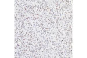 Immunohistochemistry (IHC) image for anti-Guanine Nucleotide Binding Protein-Like 3 (Nucleolar) (GNL3) (C-Term) antibody (ABIN7453884) (Nucleostemin 抗体  (C-Term))