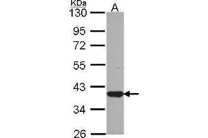 WB Image Sample (30 ug of whole cell lysate) A: JurKat 10% SDS PAGE antibody diluted at 1:1000 (LZTFL1 抗体)