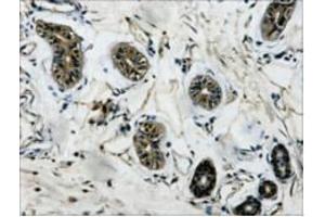 Immunohistochemistry (IHC) staining of Human Colon tissue, diluted at 1:200. (TUBB 抗体)