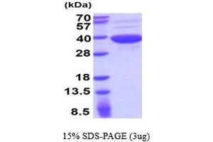 SDS-PAGE (SDS) image for Aspartoacylase (ASPA) (AA 1-313) protein (ABIN5854498) (ASPA Protein (AA 1-313))